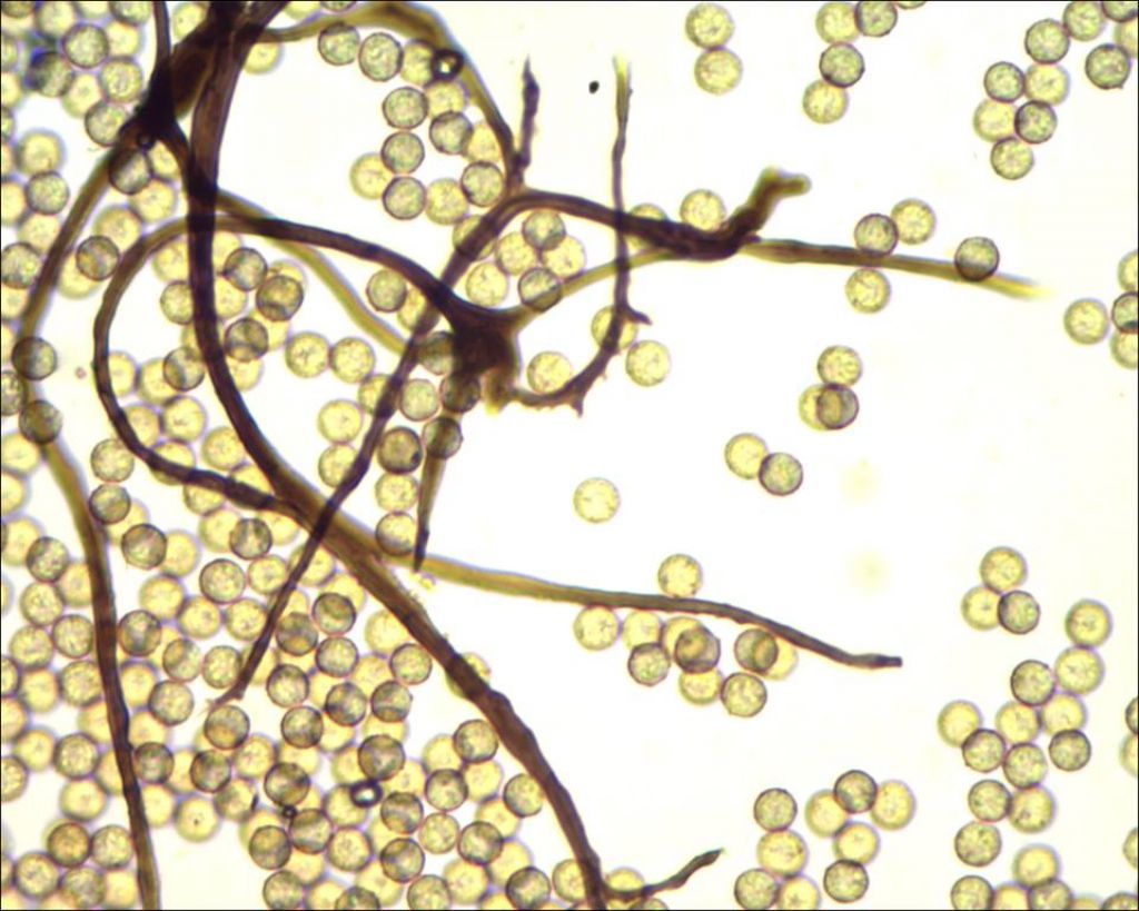 Comatricha o Stemonitopsis?